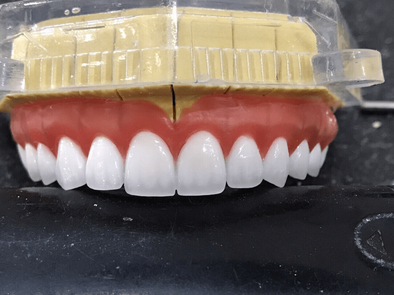 bọc răng sứ