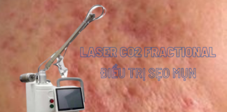 Địa chỉ bán máy Laser Trị Sẹo uy tín tại Việt Nam